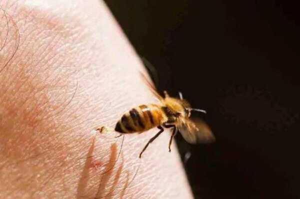 蜜蜂蛰了用什么好-给蜜蜂蛰到用什么止痒