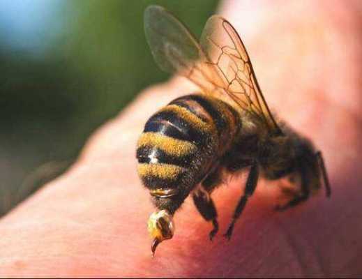 吃闷蜂子会过敏怎么办_吃蜜蜂儿过敏怎么办起包了