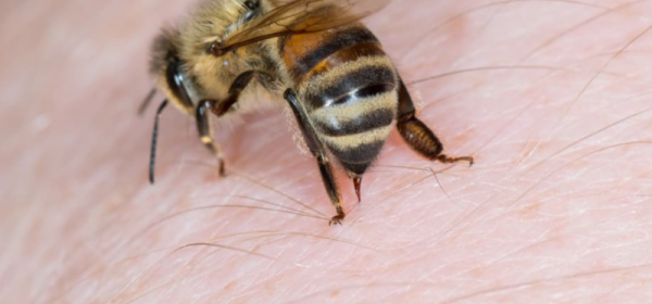吃闷蜂子会过敏怎么办_吃蜜蜂儿过敏怎么办起包了