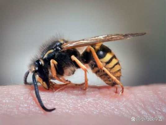 蜜蜂蛰了有什么好处_毒蜂蛰了怎么治疗