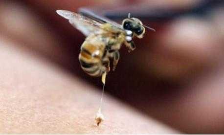 一般蜂疗是什么蜜蜂
