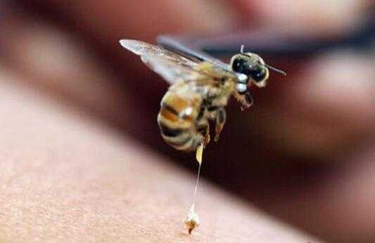  蜂针后有什么反应「蜂针疗法后的副作用」