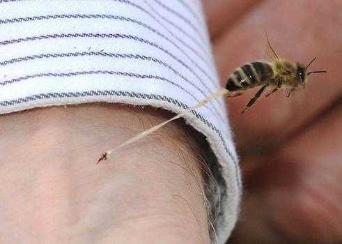 被蜜蜂刺到怎么办 被密蜂刺了怎么办