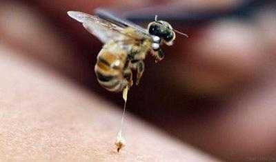 吃了蜜蜂过敏怎么办,可以用水清洗吗? 吃了蜜蜂过敏怎么办