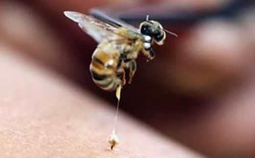  蜂针后局部过敏怎么办「蜜蜂针过敏怎么办」