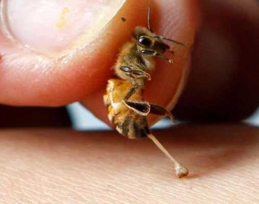 蜜蜂死后还能蜇人吗 蜜蜂死后触角怎么放