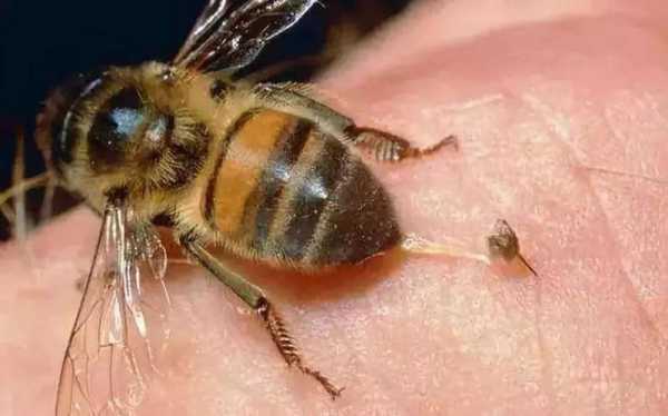 什么是蜜蜂毒_什么蜜蜂毒最多