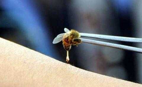 用蜜蜂治疗风湿效果视频解说 蜜蜂治疗风湿怎么收费