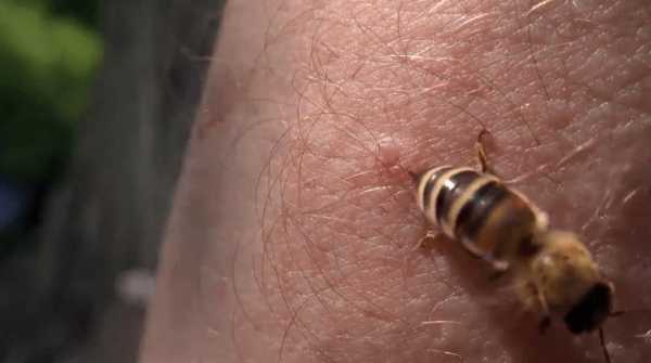 蜜蜂蛰了能涂什么止痒,蜜蜂被蛰了怎么办消肿 