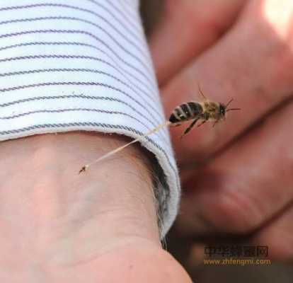 蜜蜂中毒了怎么症状 蜜蜂中毒什么症状是什么
