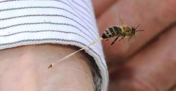 关节炎用蜜蜂治疗怎么回事,关节炎可以用蜜蜂治吗 