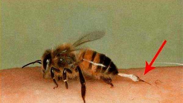 蜜蜂中毒严重怎么办
