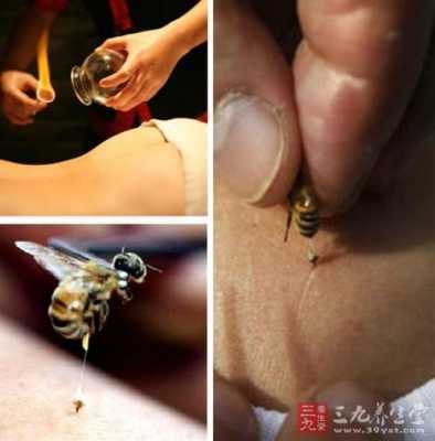 蜜蜂治疗什么疾_蜜蜂疗法能治病