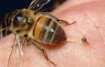  什么蜂可以蜇死人「什么蜜蜂可以蛰死人」