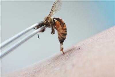 打蜂蜜针治疗什么病_扎蜂蜜针
